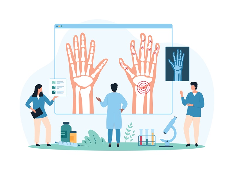 リウマチの治療